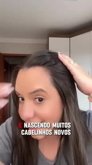 Resultado de crescimento capilar com a vitamina Magia Grow